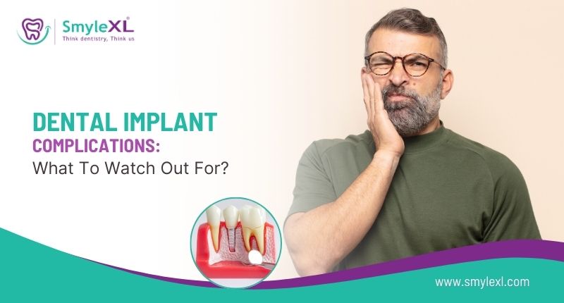 Dental Implant Complications: What to Watch Out For