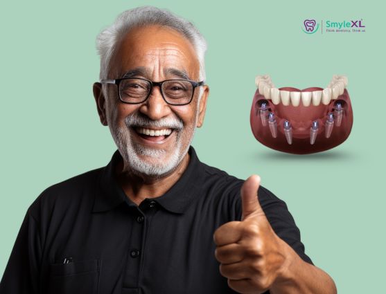 Full Mouth Restoration in Ashiyana Lucknow