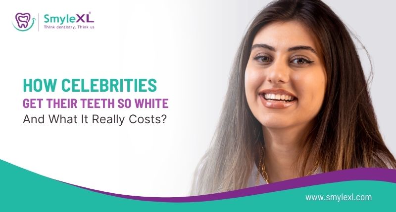 How Celebrities Get Their Teeth So White