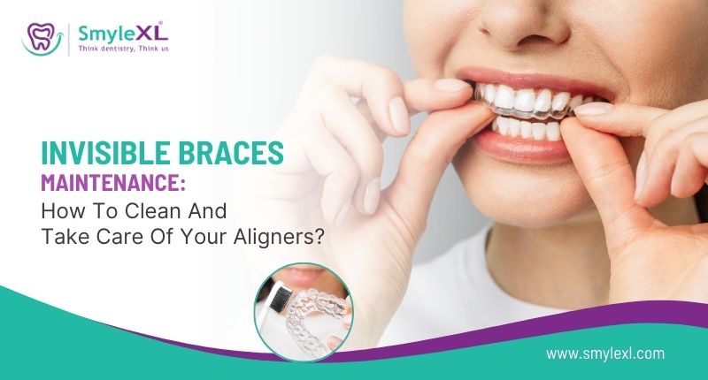 Invisible Braces Maintenance: How to Clean and Take Care of Your Aligners
