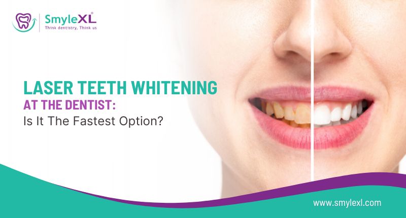 Laser Teeth Whitening at the Dentist: Is It the Fastest Option?