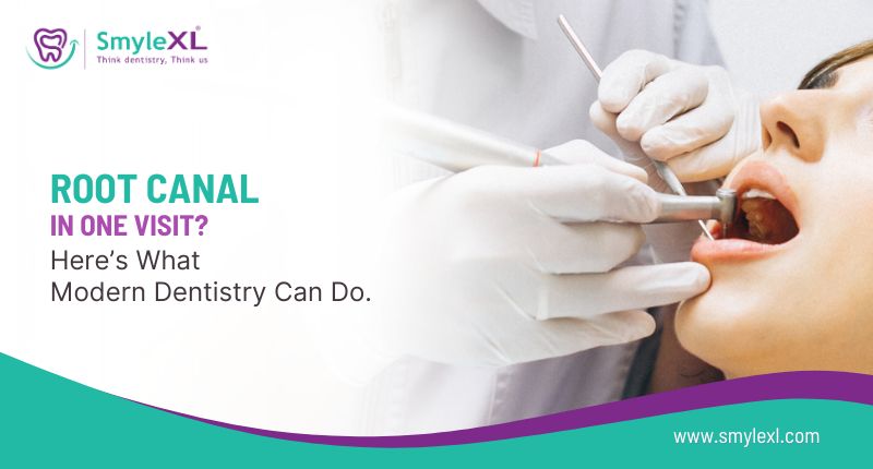ROOT CANAL IN ONE VISIT? HERE’S WHAT MODERN DENTISTRY CAN DO