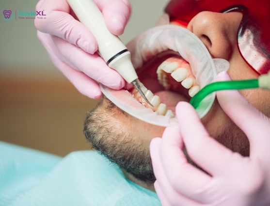 Teeth Cleaning Treatment in Ashiyana Lucknow