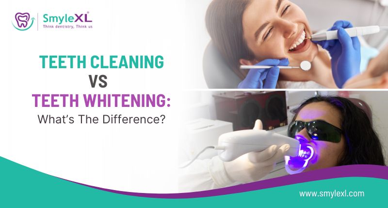 Teeth Cleaning vs Whitening: What’s the Difference?