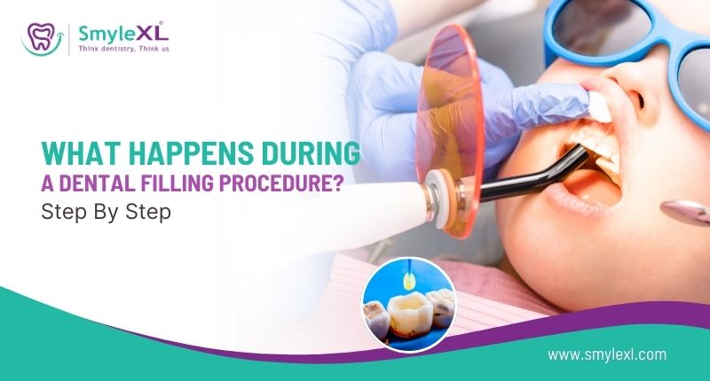What Happens During a Dental Filling Procedure? Step by Step