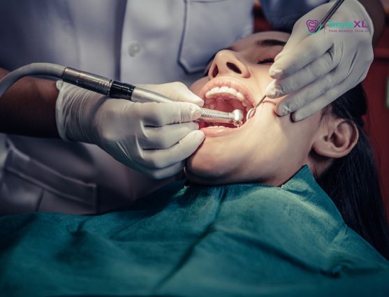 Root Canal Treatment in Ashiyana, Lucknow