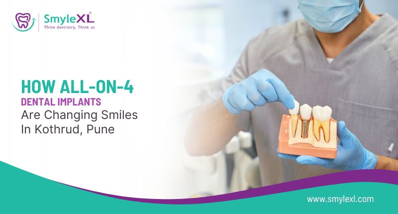 How All-on-4 Dental Implants Are Changing Smiles in Kothrud, Pune