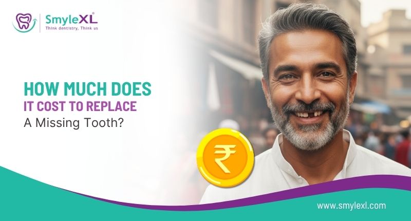 How Much Does It Cost to Replace a Missing Tooth?