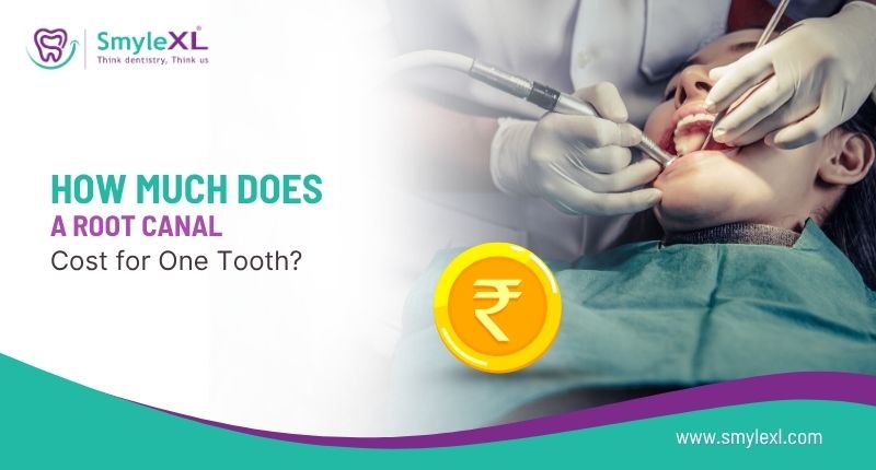 How Much Does a Root Canal Cost for One Tooth?