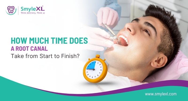 How Much Time Does a Root Canal Take from Start to Finish?