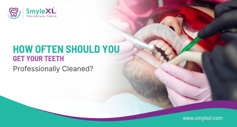 How Often Should You Get Your Teeth Professionally Cleaned?