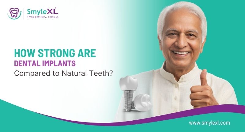 How Strong Are Dental Implants Compared to Natural Teeth?