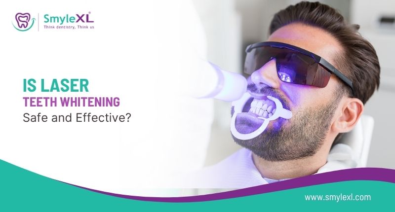 Is Laser Teeth Whitening Safe and Effective?