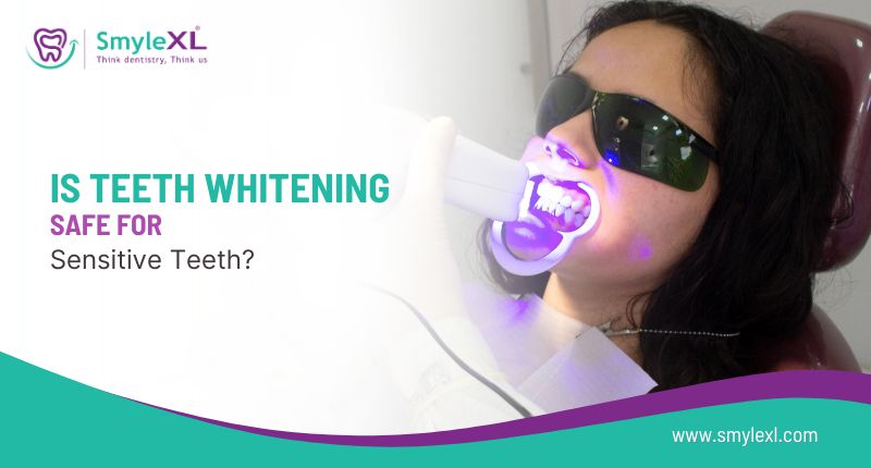 Is Teeth Whitening Safe for Sensitive Teeth?