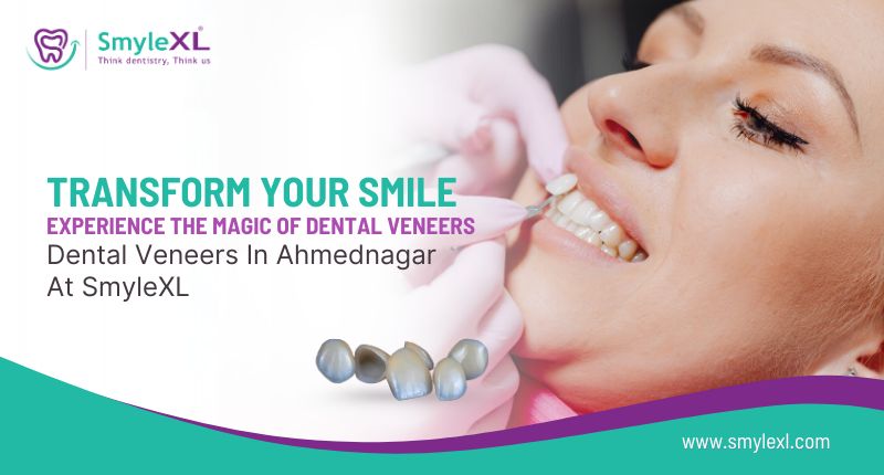 Transform Your Smile: Experience The Magic of Dental Veneers in Ahmednagar At SmyleXL