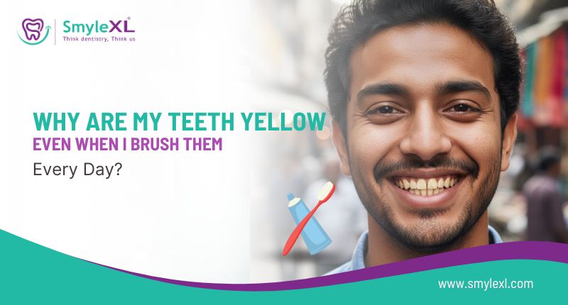 Why Are My Teeth Yellow Even When I Brush Them Every Day?