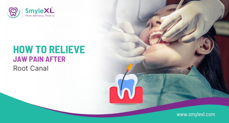 How to Relieve Jaw Pain After a Root Canal
