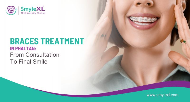 Braces Treatment in Phaltan: From Consultation to Final Smile