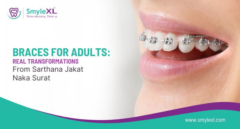 Braces for Adults: Real Transformation Stories from Sarthana Jakat Naka Surat