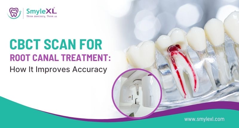 CBCT Scan for Root Canal Treatment: How It Improves Accuracy