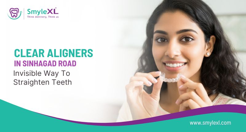 Clear Aligners in Sinhagad Road: Invisible Way to Straighten Teeth