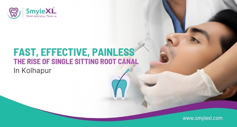 Fast, Effective, Painless: The Rise of Single Sitting Root Canal in Kolhapur