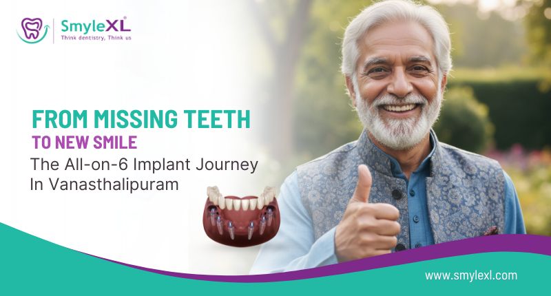From Missing Teeth to New Smile: The All-on-6 Implant Journey in Vanasthalipuram