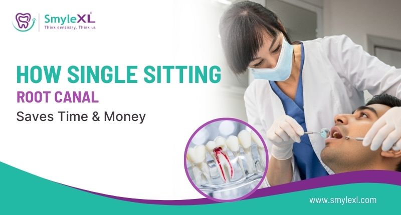 How Single Sitting Root Canal Saves Time & Money