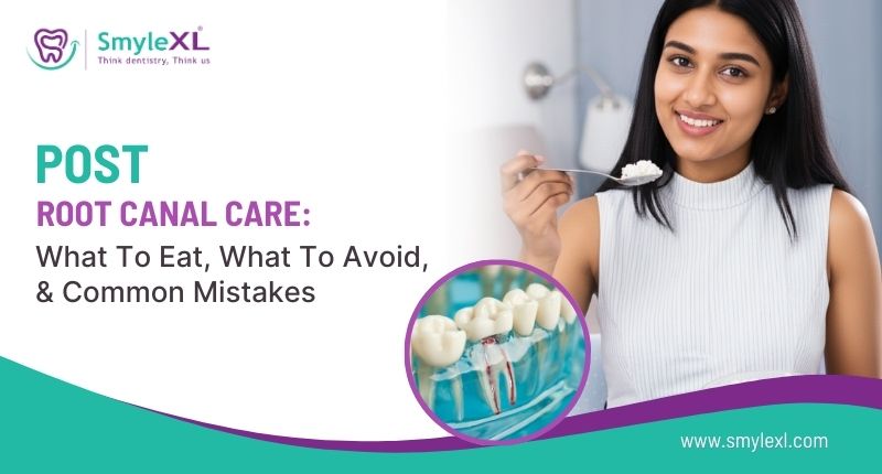 Post-Root Canal Care: What to Eat, What to Avoid, and Common Mistakes