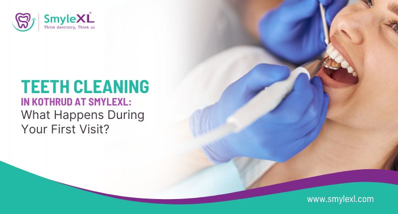 Teeth Cleaning in Kothrud At SmyleXL: What Happens During Your First Visit?
