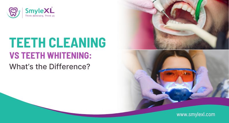 Teeth Cleaning vs Teeth Whitening: What’s the Difference?