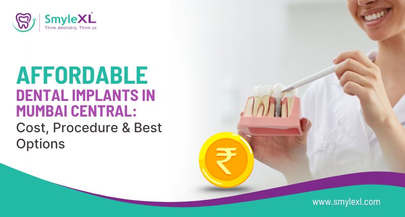 Affordable Dental Implants in Mumbai Central: Cost, Procedure & Best Options