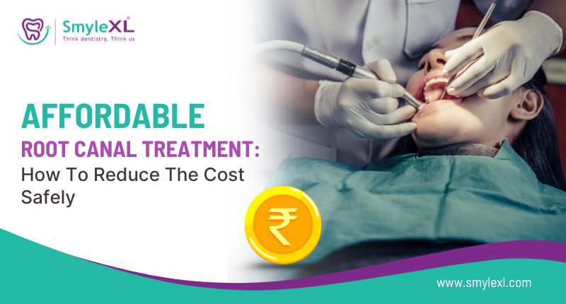 Affordable Root Canal Treatment: How to Reduce the Cost Safely