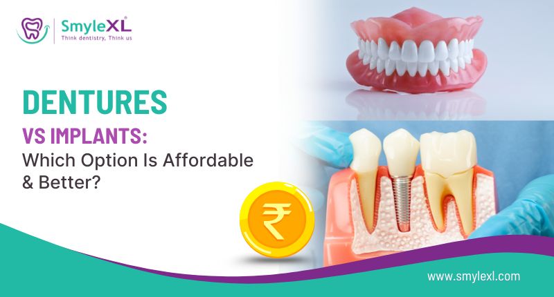 Dentures vs Implants: Which Option Is Affordable & Better?