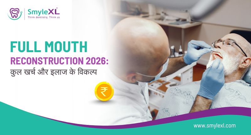 फुल माउथ रिकंस्ट्रक्शन 2026: कुल खर्च और इलाज के विकल्प