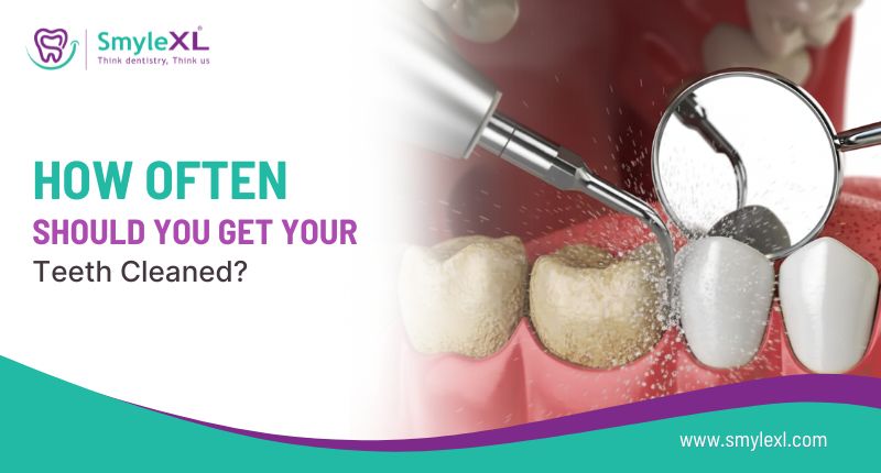 How Often Should You Have a Dental Cleaning?