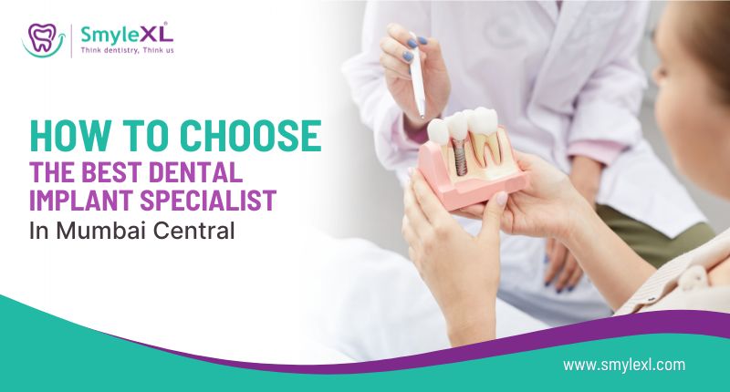 How to Choose the Best Dental Implant Specialist in Mumbai Central