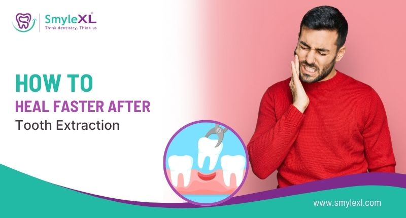 How to Heal Faster After Tooth Extraction