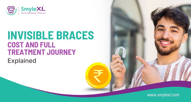 Invisible Braces Cost and Full Treatment Journey Explained