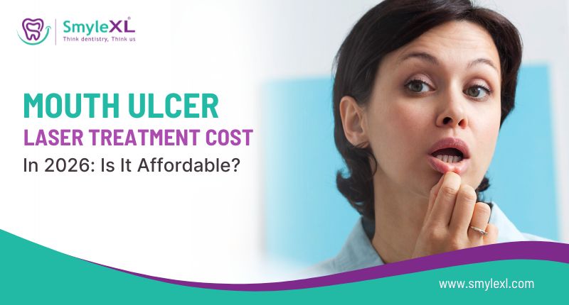 Mouth Ulcer Laser Treatment Cost in 2026: Is It Affordable?