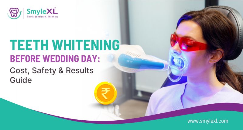 Teeth Whitening Before Wedding Day: Cost, Safety & Results Guide