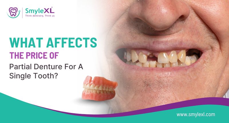 What affects the price of a partial denture for a single tooth?