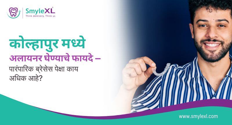 कोल्हापूरमध्ये अलाइनर घेण्याचे फायदे — पारंपारिक ब्रेसेसपेक्षा काय अधिक आहे?