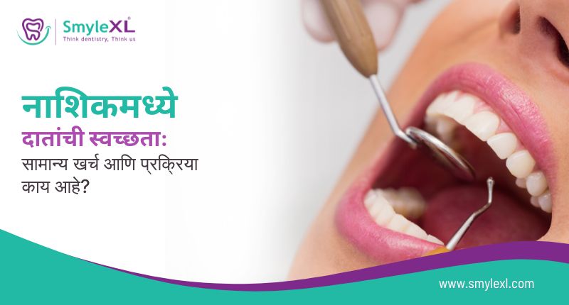 नाशिकमध्ये दातांची स्वच्छता: सामान्य खर्च आणि प्रक्रिया काय आहे?