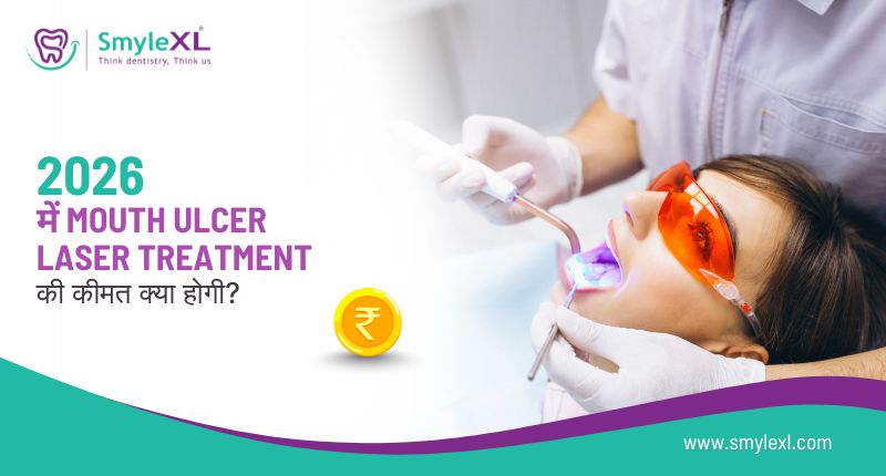 2026 में Mouth Ulcer Laser Treatment की कीमत क्या होगी?