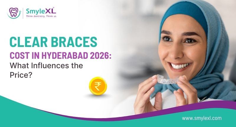 Clear Braces Cost in Hyderabad 2026: What Influences the Price?