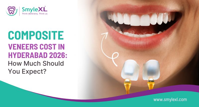 Composite Veneers Cost in Hyderabad 2026: How Much Should You Expect?
