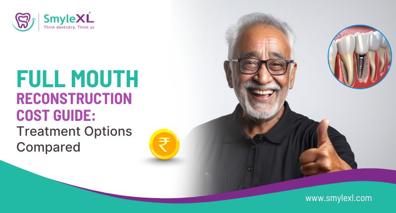 Full Mouth Reconstruction Cost Guide: Treatment Options Compared
