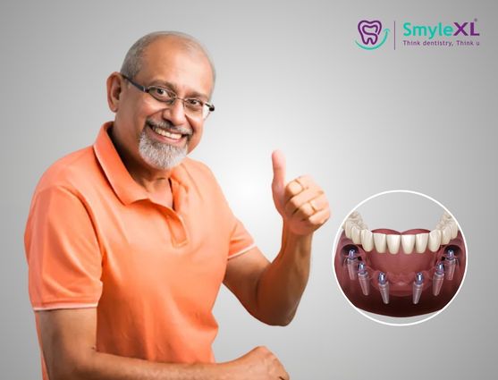 Full Mouth Restoration in Chitradurga