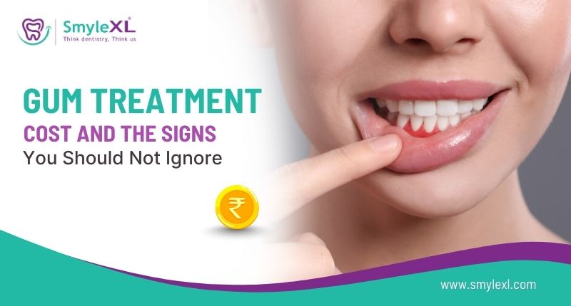 Gum Treatment Cost and the Signs You Should Not Ignore